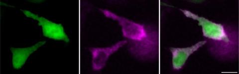 A photo of glowing RNA molecules.